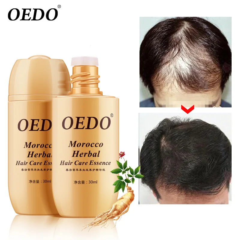 

OEDO Brand Morocco Hair Care Essence Herbal Ginseng Treatment Hair Loss Fast Powerful Hair Growth Serum Repair Hair root 30ml