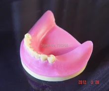 Senior Teeth Planting Practice Model,Dental Planting Skill Practice Model quick guidelines on dental practice