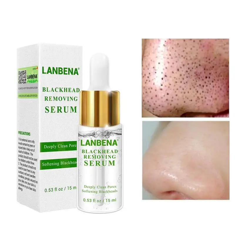 Blackhead Export Solution Serum Hyaluronic Acid Serum Anti aging