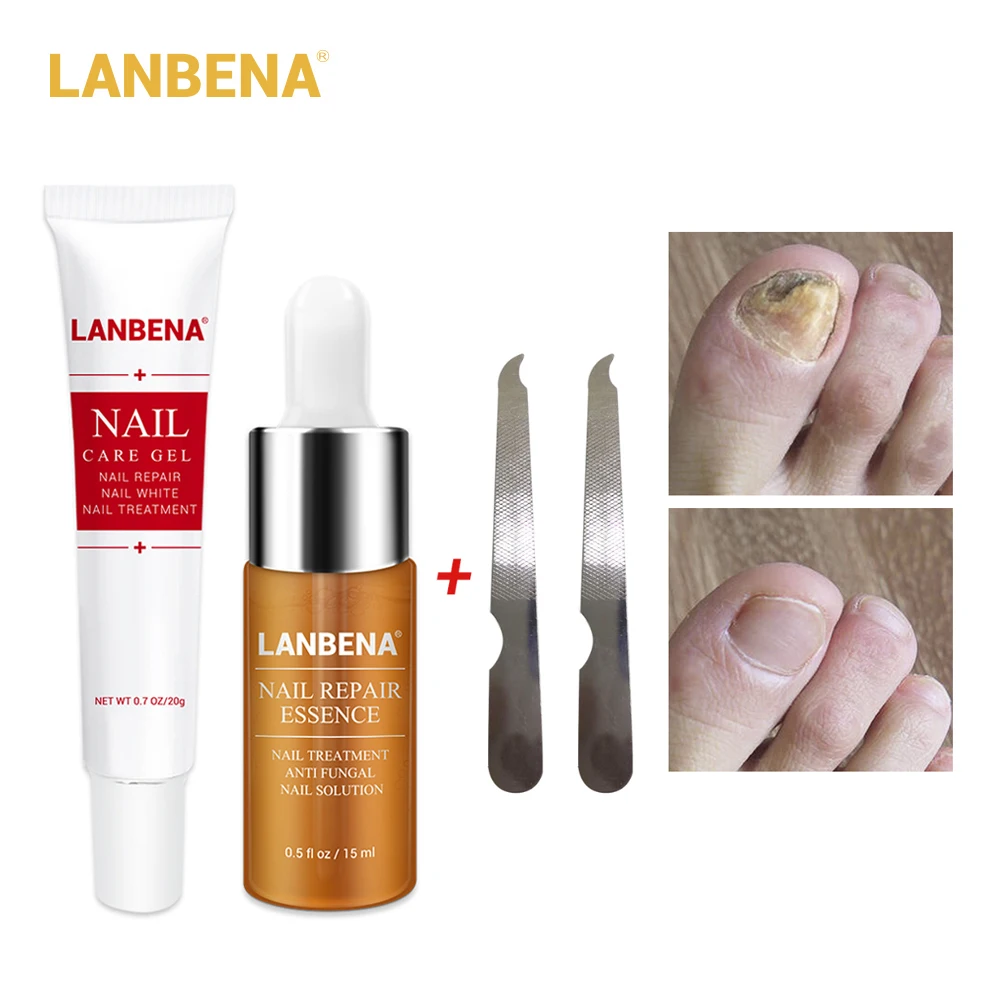LANBENA для ухода за ногтями эссенция Сыворотки + гель лак ногтей Уход удалить