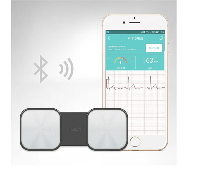 Pelvifine беспроводной ручной ЭКГ сердечный монитор для сердечного ритма без электрода домашний ЭКГ трекер Мониторинг ios Android