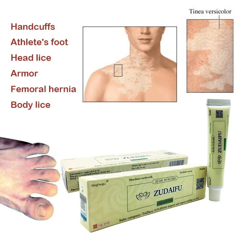 Buy Professional Cure Psoriasis Ointment Medicine