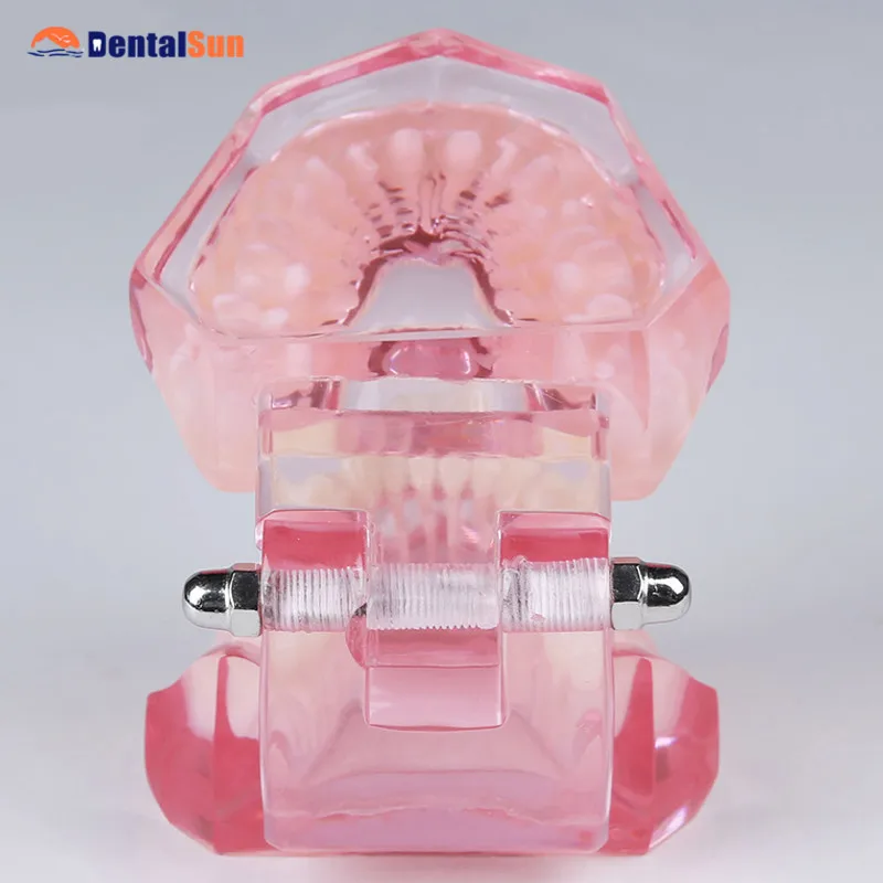 

Dental Demonstration Model/M6002 Overdenture Inferior model with 2 implant