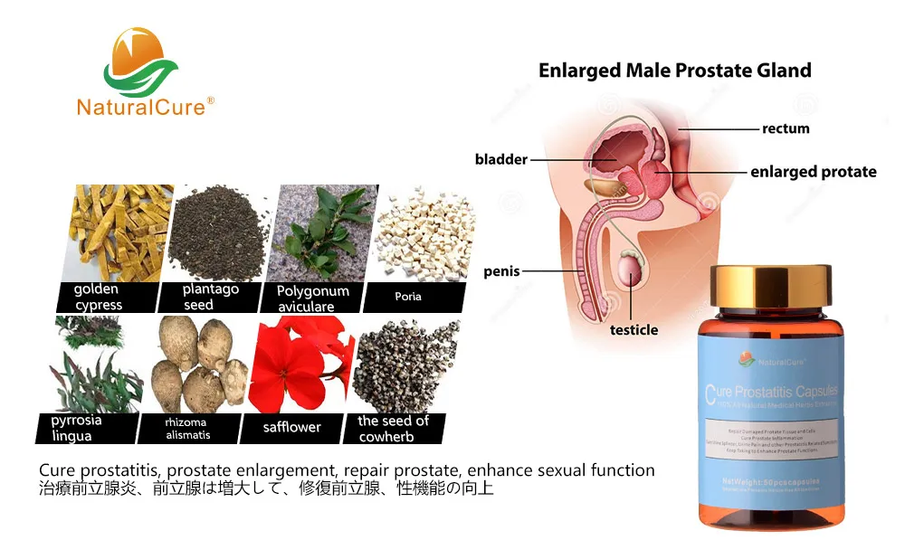 prostatitis ülés journal of prostate cancer impact factor