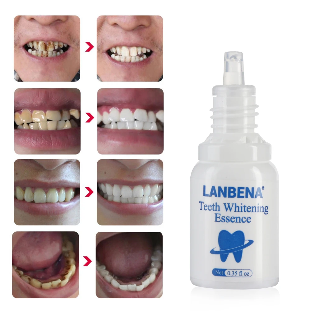 10ml Liquid Oral Hygiene Cleaning Teeth Whitening Essence Serum Removes Plaque Stains Tooth