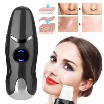 

Portable Ultrasonic Vibration Skin Scrubber Deep Cleansing Spatula Blackheads Grease Removal Ultrasonic Pores Cleaner Skin Care