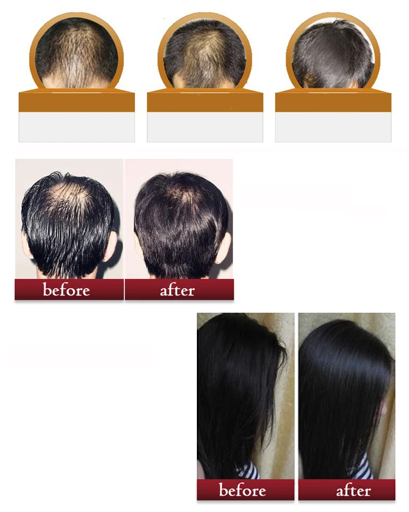 Lanthome Brand Hair Care Products 100 Genuine Repair Damaged