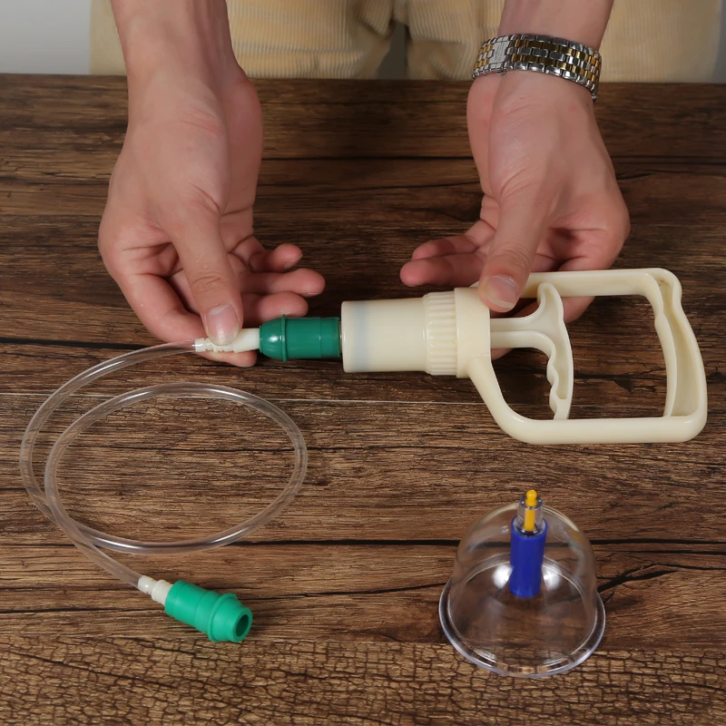 vacuum cupping (6)