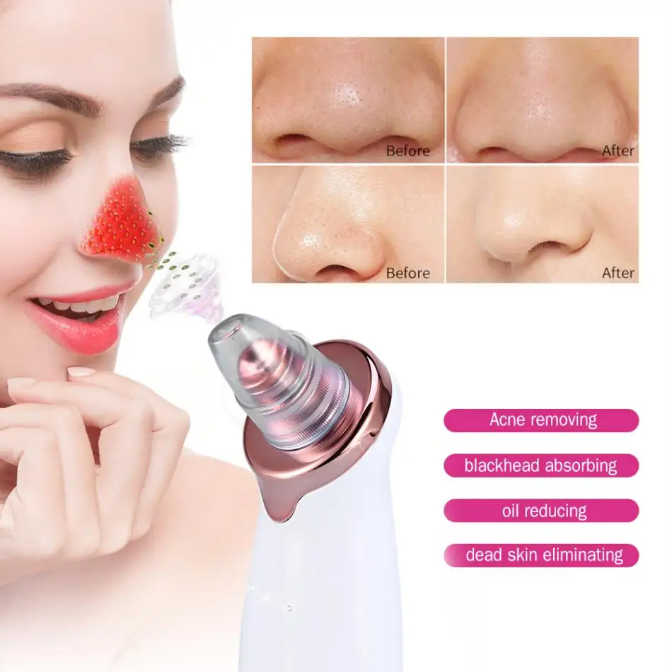Вакуум удаления угрей Acne мертвой кожи морщины Remover лица подъемные машины очиститель пор дермабразия Черноголовых ингалятор