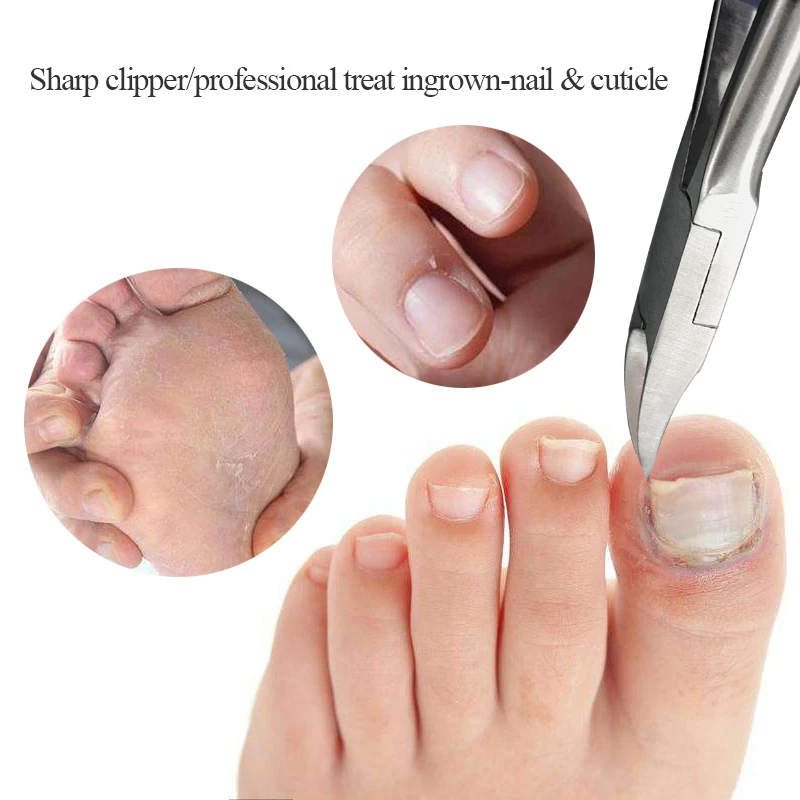 Nail-Clippers-Ingrown-Toenail-Podiatry-Correction-Nippers-Cuticle-Cutters-Cut-Paronychia-Pedicure-Manicure-Hand-Foot-Care-Tool (1)