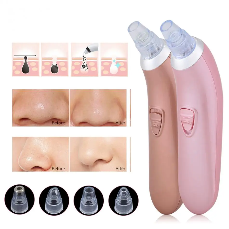 

Handheld Electric Blackhead Remover Cleaner Vacuum Suction Facia Blackhead Removal Skin Care Cleansing Tool Pore Cleaner