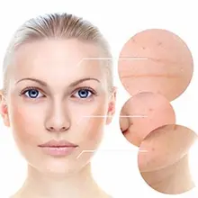 DMAE MSM сыворотка натуральный органический укрепляющий крем для кожи против старения морщин уход за кожей