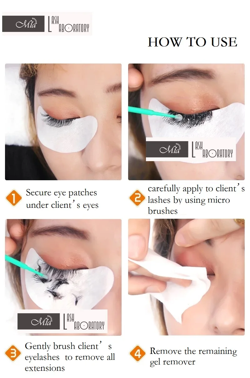 remover3