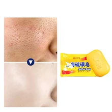 Серное мыло для клеща от акне, псориаза себорейного клеща противогрибковый дерматит FZ-05