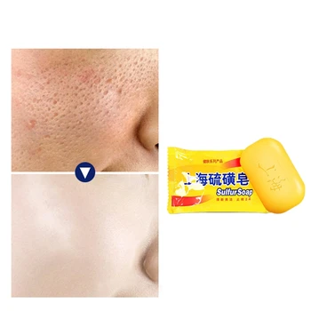 

Sulfur Soap for Mite Acne Psoriasis Seborrheic Mite Antifungal Dermatitis FZ-05