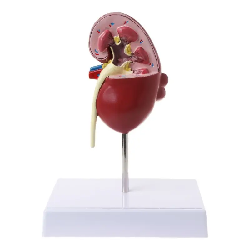 Анатомическая анатомическая больная патологическая каменная модель для обучения органов в натуральную величину