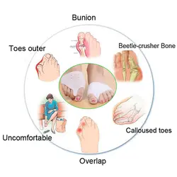 Горячая продажа 1 пара силиконовые пальцы ног приспособление для разделения Bunion шина Выпрямитель Корректор вальгусной деформации