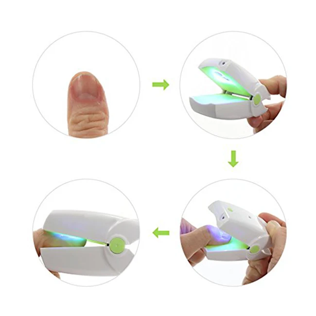 

Highly Effective Rechargeable Nail Fungus Laser Treatment Device Nail Infection Onychomycosis Cure Nail Fungal Infections