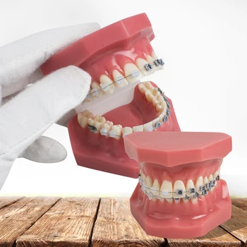 

Dental Teeth Study Orthodontic Red Model with Metal and Ceramic Brackets Teeth Mold