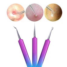 1 шт. чёрные точки комедоны акне жидкость для снятия изогнутые щипцы нержавеющая Красота очиститель прибор для ухода за лицом