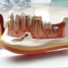 Модель человека Ортодонтическая модель стоматологические модели имплантатов для взрослых гингива разлагается