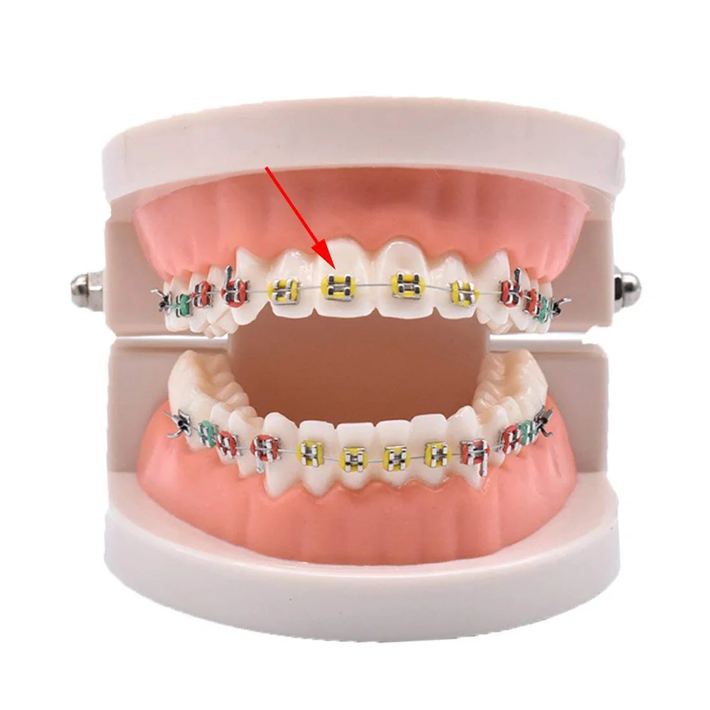 

10pcs Dental Orthodontic Ligature Ties Elastic Rubber Bands Tools Elasticity For Teeth 666
