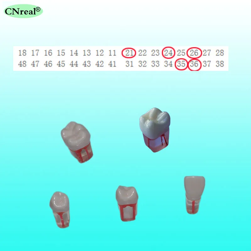 5 шт./компл. ендодонтик практика модель зубов для RCT прозрачный смолы с окрашенная корневого канала