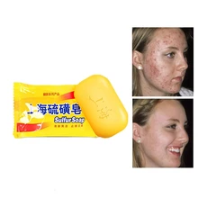 Новое поступление, забота о здоровье, Шанхай, серное мыло, 85 г, аллергия, контроль свежего масла, антибактериальное, противовоспалительное, глубокое очищение