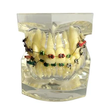 1 Piece Dental Orthodontic Study Model Transparent Teeth Malocclusion Orthodontic Model with Colorful Brackets & Hoops Hot Sale