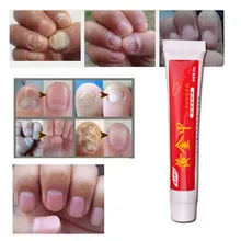 

2pcs Nail Fungus Treatment / Onychomycosis Paronychia / Anti Fungal Nail Infection Good Result Chinese Herbal Toe Nail Treatment