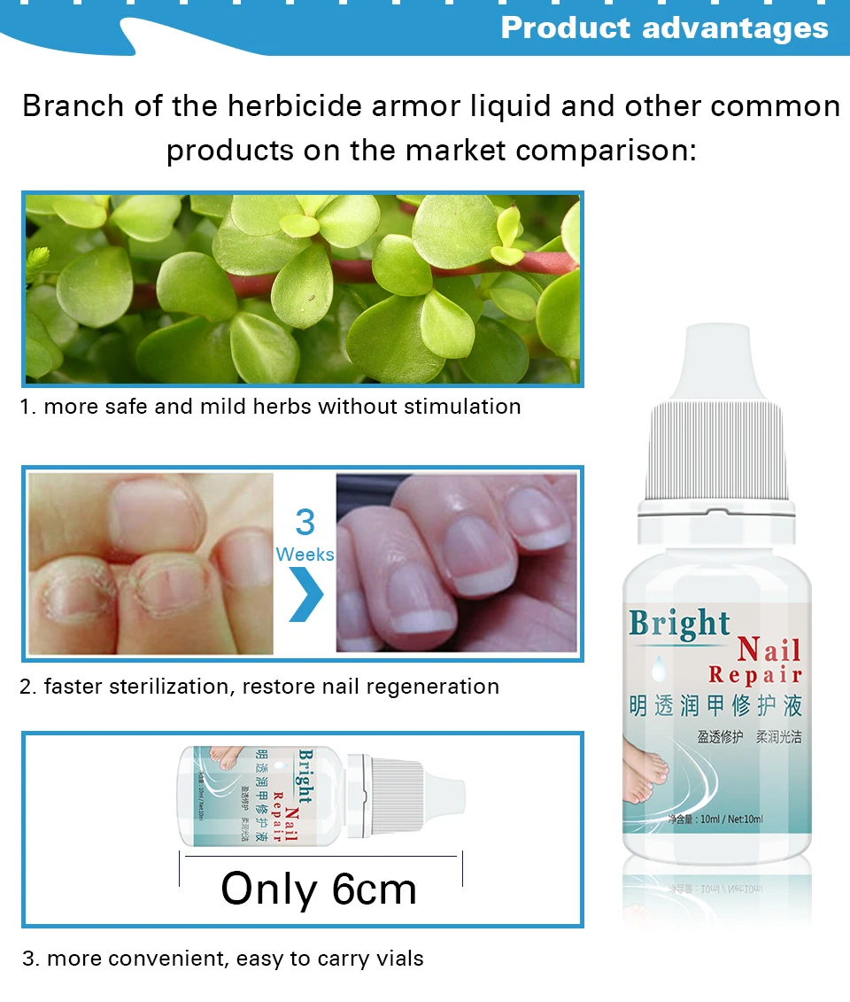 2 шт для ремонта ногтей эссенция сыворотка Лечение ногтей от грибка удаление онихомикоза рук и ног уход за носками питательный блеск