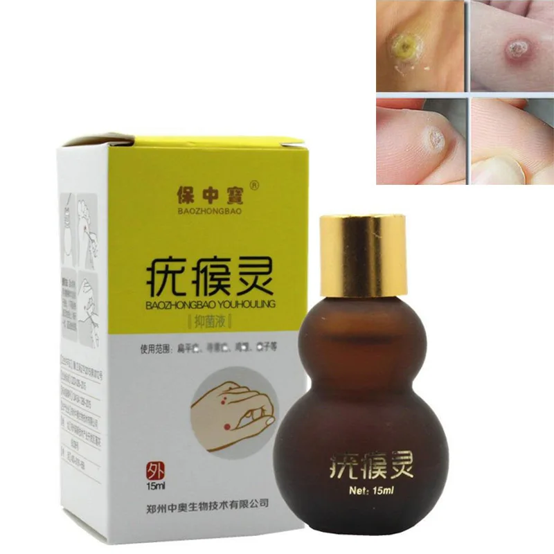 

Youhouling Liquid Corn Hedgehog Rapire Dermatological Fluid Health99