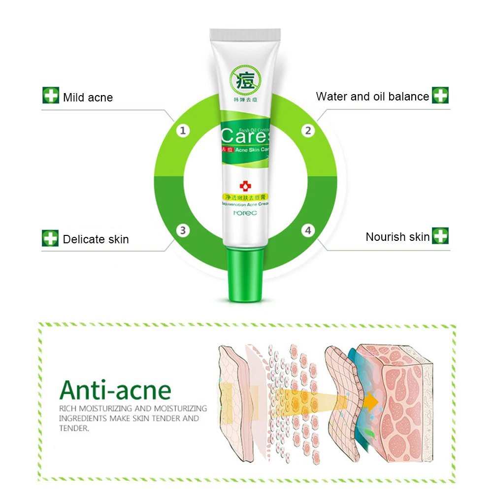 1 предмет; акне крем Acne гель для удаления шрам крем акне отбеливающий гель увлажняющий сокращения пор Красота уход за кожей лица