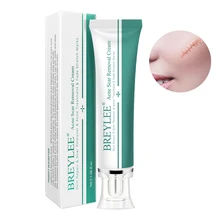 30 г черных точек тела для ухода за лицом лечение шрамов крем для удаления пятен опреснения травяные восстановления кожи сжимает поры, акне уход за кожей