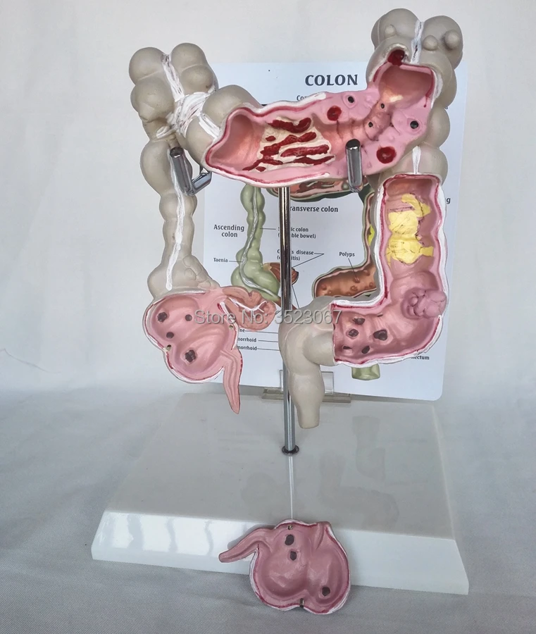 

4D Human Life Size Brain anatomy organs Model Anatomical Medical skull skeleton anatomical Colon Model with Pathologies