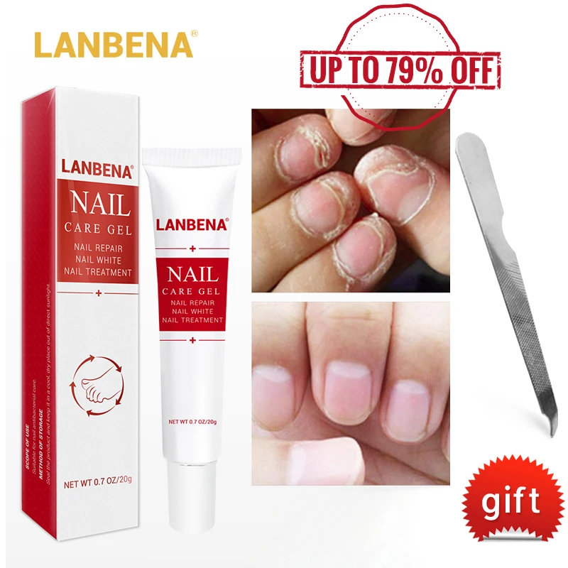 

LANBENA Nail Care Gel Fungal Nail Treatment Remove Onychomycosis Nail Care Nourishing Effective against nail Hand And Foot Care
