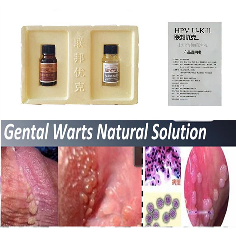 Genital warts condylomata