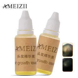 AMEIZII 2 шт. средство для роста волос масло для выпадения волос Жидкое натуральное эфирное средство для ухода за волосами предотвращает