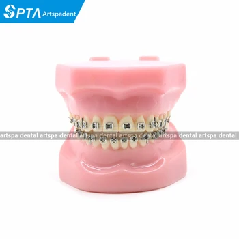 

Dental Orthodontics Typodont Teeth Model Metal Brace bracket Typodont with Arch Wire