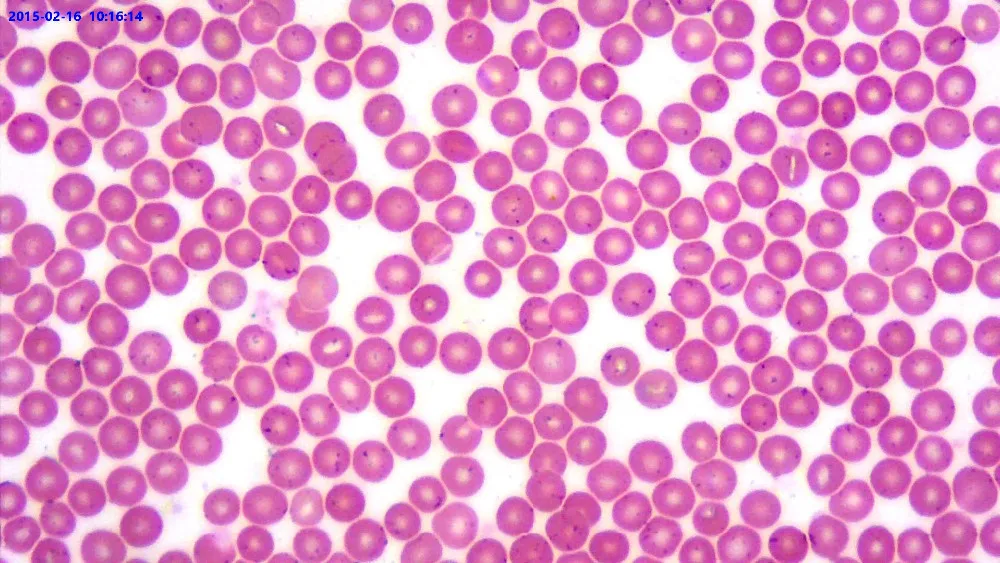 89_Human_Blood_Smear