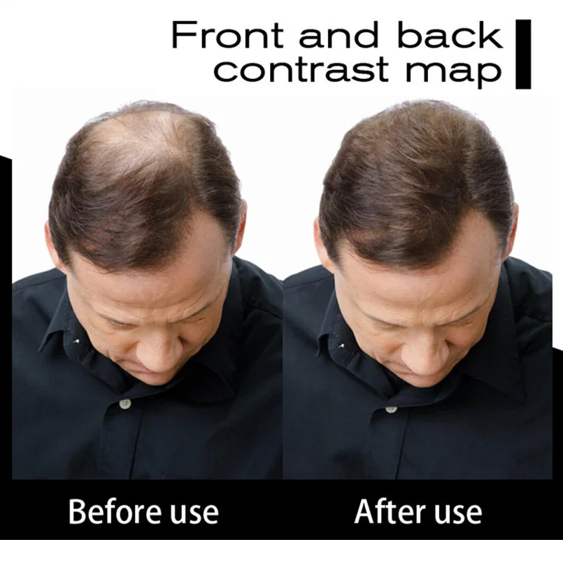 SEVICH Brand Hair Building Fiber Hair Styling 25g Keratin Hair Fiber Spray Applicator Professional Hair Loss Products Mauqiagem SEVICH Brand Hair Building Fiber Hair Styling 25g Keratin Hair Fiber Spray Applicator Professional Hair Loss Products Mauqiagem