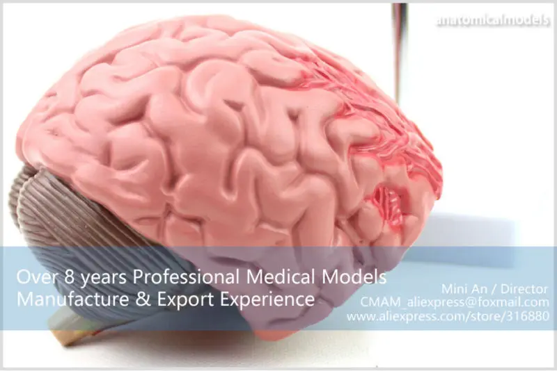 BRAIN10 CMAM model brain diseases anatomical model 3