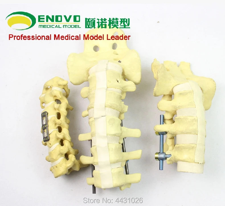ENOVO Human Cervical Spine Model Anatomy Model Spine Statues Medical Science Teaching