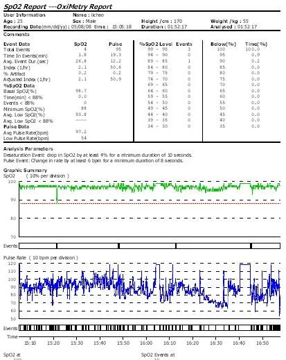 Bluetooth беспроводной Палец кончик Пульсоксиметр насыщение крови кислородом монитор CMS50EW, USB SW, oled-экран, CONTEC Oximetro