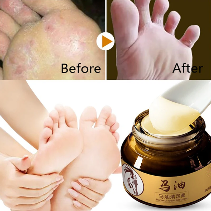 

Horse Oil Feet Cream Care Beriberi Cream For Athlete's Foot Feet Itch Blisters Anti-chapping Peeling Beriberi Bad Feet Ointment