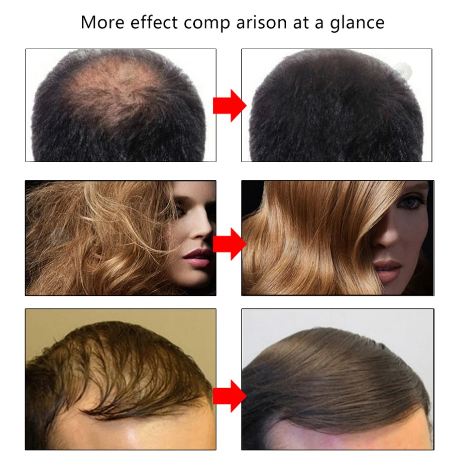 Hair Growth Essence Hair Loss Dense Hair Fast Hair Growth Grow Restoration Growing Serum Essential Oil