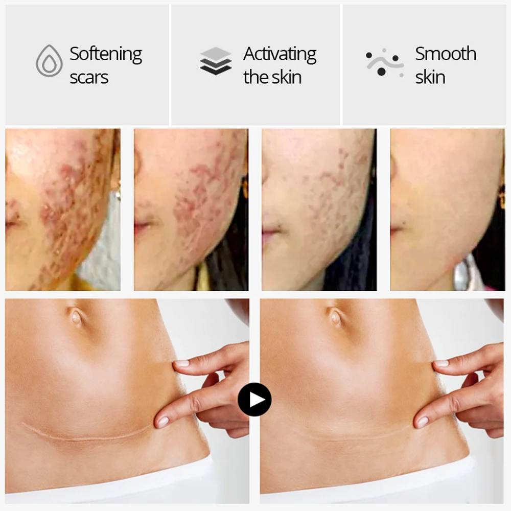 VIBRANT GLAMOUR Crocodile Dispel Scar Repair Face Serum Remove Acne Scar Stretch Marks Treatment Skin Lightening Whitening Care