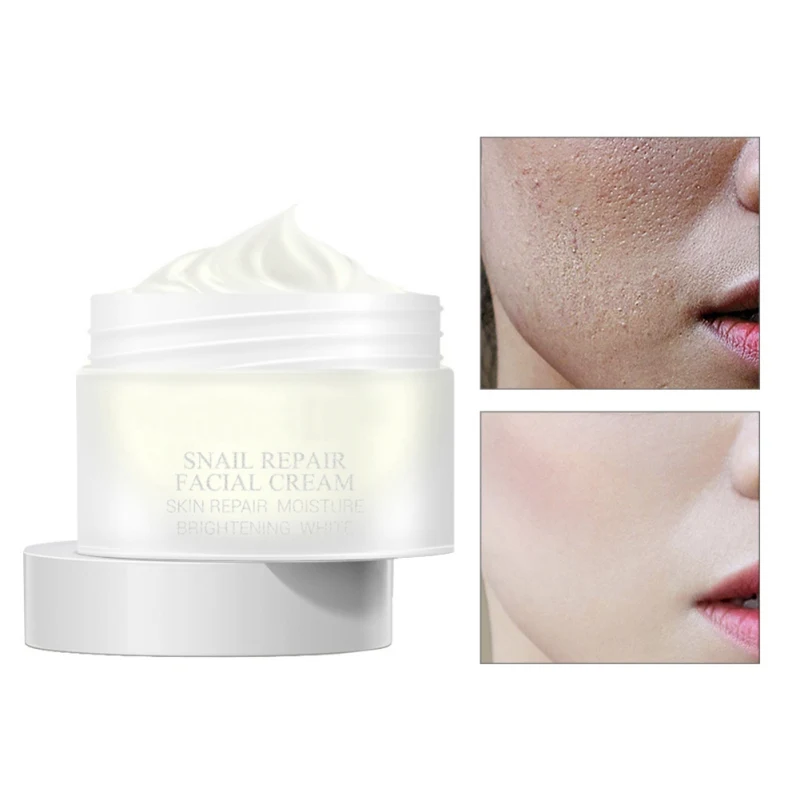 

Snail Serum Repair Face Cream Essence Skin Care Aging Aniti Wrinkle Remove Acne Treatment Facial Care Oil-Control Cream