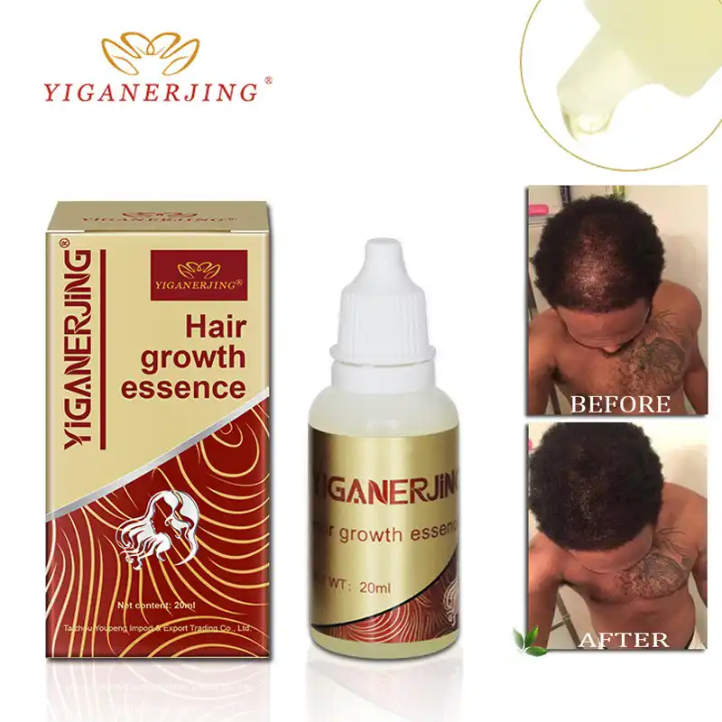 Yiganerjing Hair Growth Agent Products Anti Hair Loss Natural