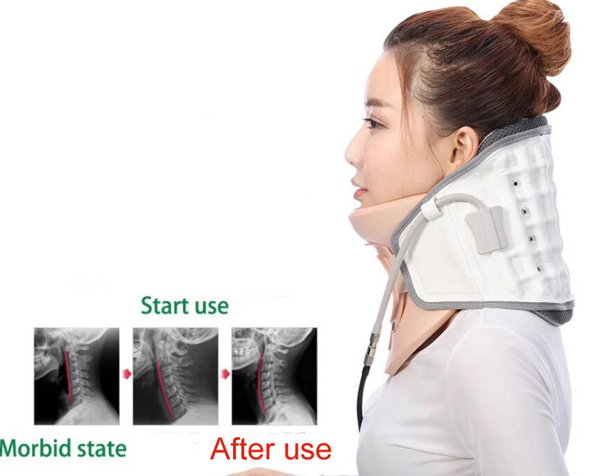 Шейный Тяговый прибор бытовой растягивающийся шейный Тяговый надувной шейный спондилез воротник подвесной шейный каркас